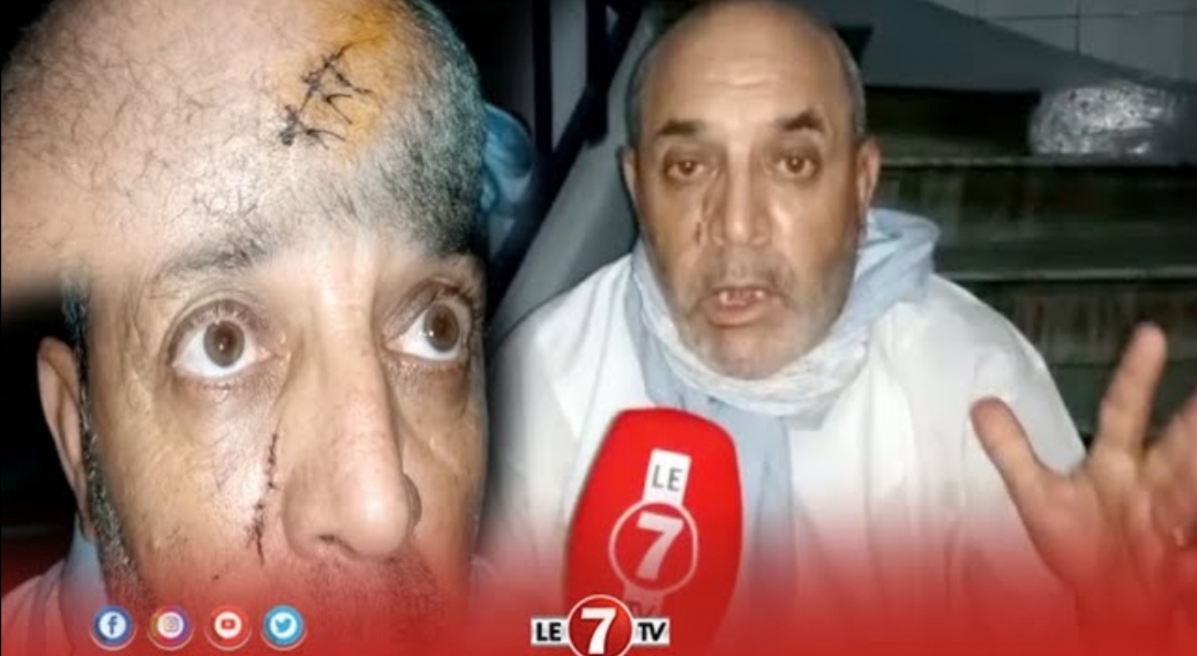 “مقرئ” يتعرض لإعتداء شنيع بـ”سلاح الأبيض” من طرف مجهول .. “تعدى عليا وكان باغي يقتلني”