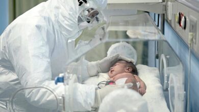 Photo of وفاة طفل رضيع عمره 3 أسابيع نتيجة ” إصابة شديدة ” بفيروس ” كورونا “