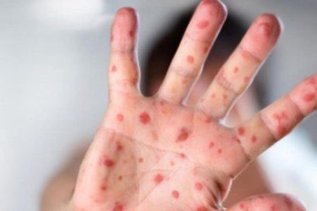 ” بوحمرون” يودي بحياة طفل إقليم شيشاوة